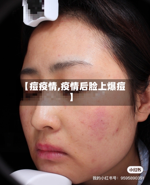 【痘疫情,疫情后脸上爆痘】