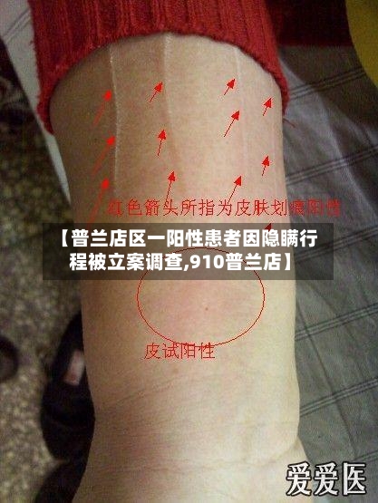 【普兰店区一阳性患者因隐瞒行程被立案调查,910普兰店】-第3张图片